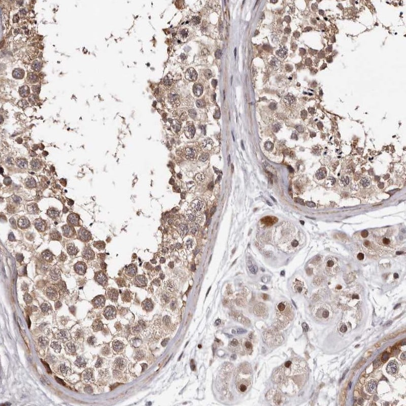 PHF20L1 Antibody - BSA Free Immunohistochemistry: PHF20L1 Antibody - BSA Free [NBP1-84501]
