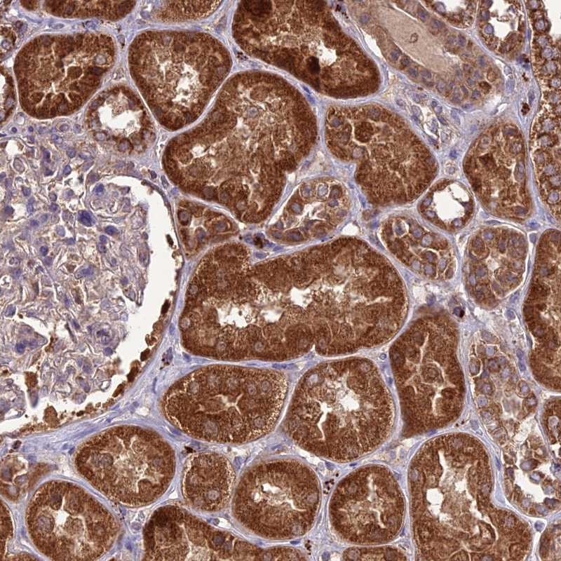 NDUFAF1 Antibody - BSA Free Immunohistochemistry-Paraffin: NDUFAF1 Antibody [NBP1-84503]