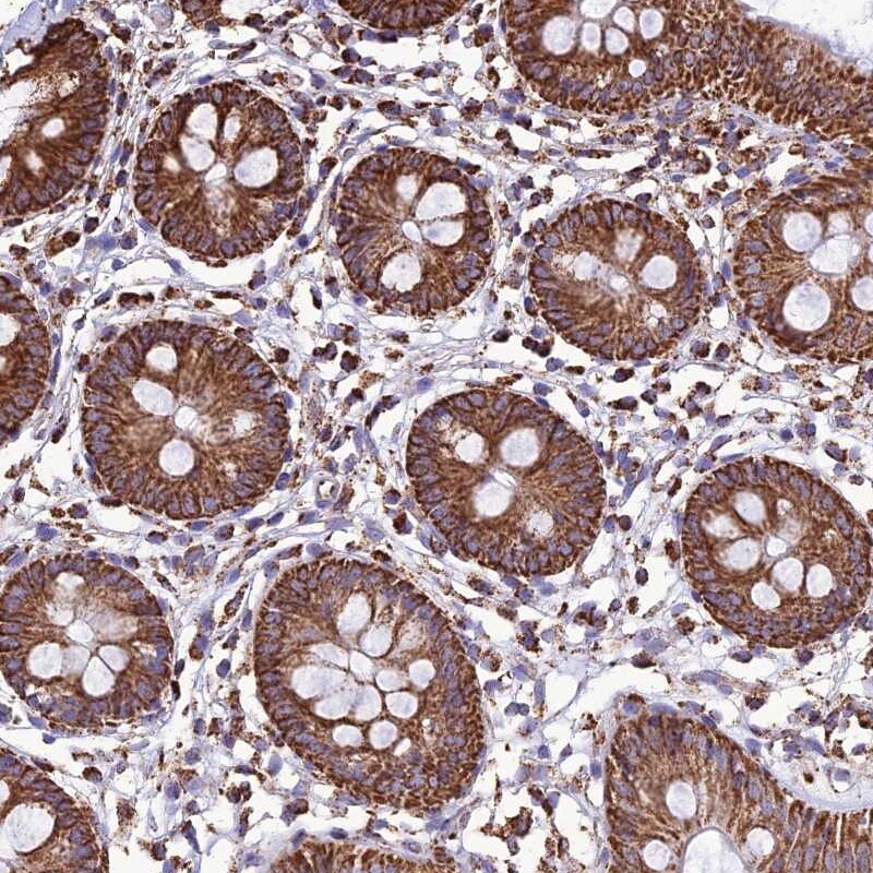 NDUFAF1 Antibody - BSA Free Immunohistochemistry-Paraffin: NDUFAF1 Antibody [NBP1-84504]