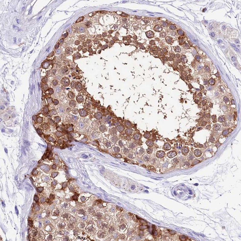 Abhd5 Antibody - BSA Free Immunohistochemistry-Paraffin: Abhd5 Antibody - BSA Free [NBP1-84506]