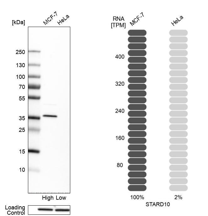 STARD10 Antibody - BSA Free Western Blot: STARD10 Antibody - BSA Free [NBP1-84508]