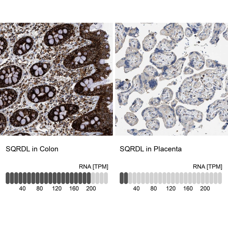 SQRDL Antibody - BSA Free Immunohistochemistry-Paraffin: SQRDL Antibody [NBP1-84510]