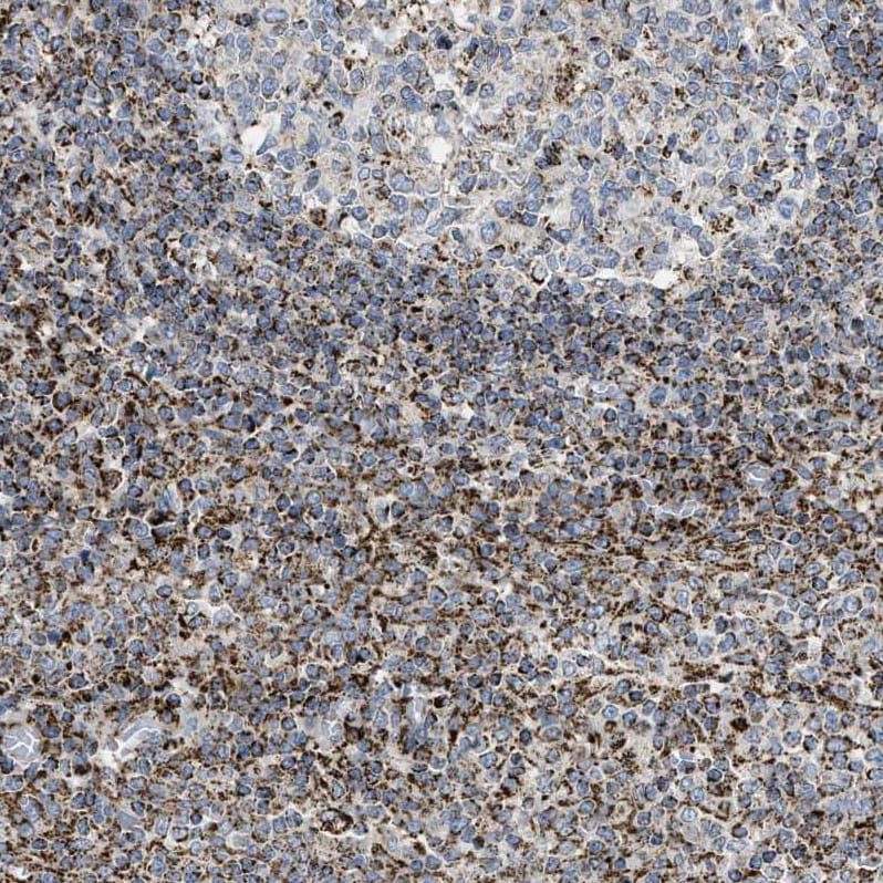 SQRDL Antibody - BSA Free Immunohistochemistry-Paraffin: SQRDL Antibody [NBP1-84510]