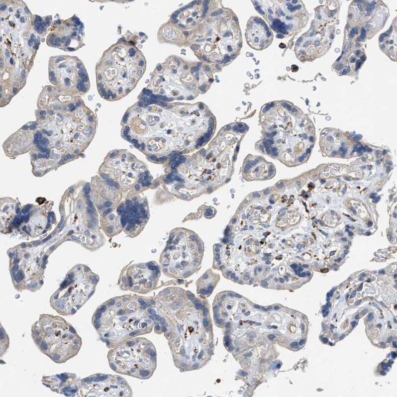 SQRDL Antibody - BSA Free Immunohistochemistry-Paraffin: SQRDL Antibody [NBP1-84510]