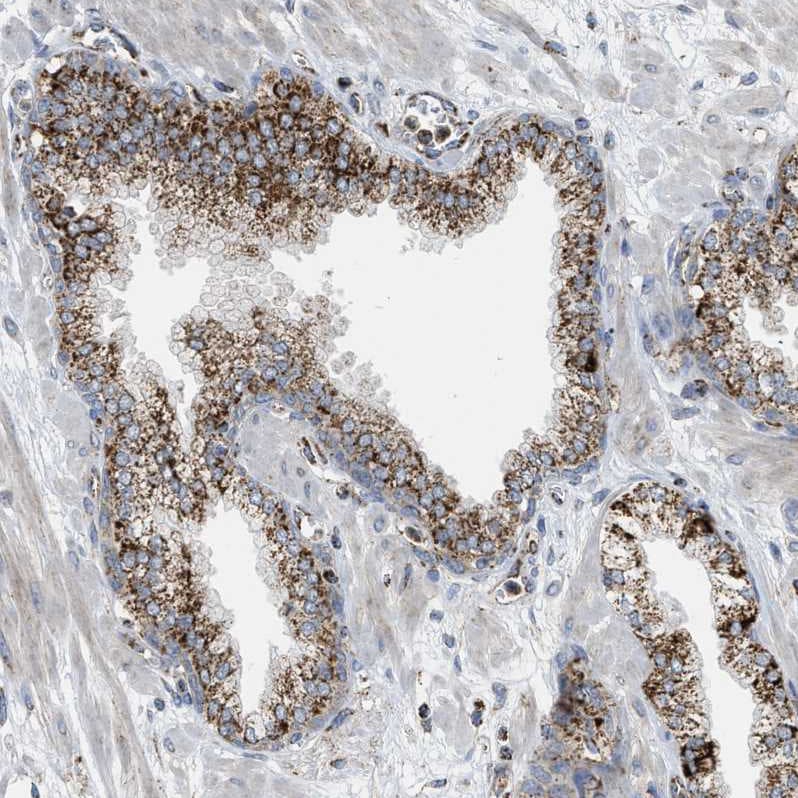 SQRDL Antibody - BSA Free Immunohistochemistry-Paraffin: SQRDL Antibody [NBP1-84510]