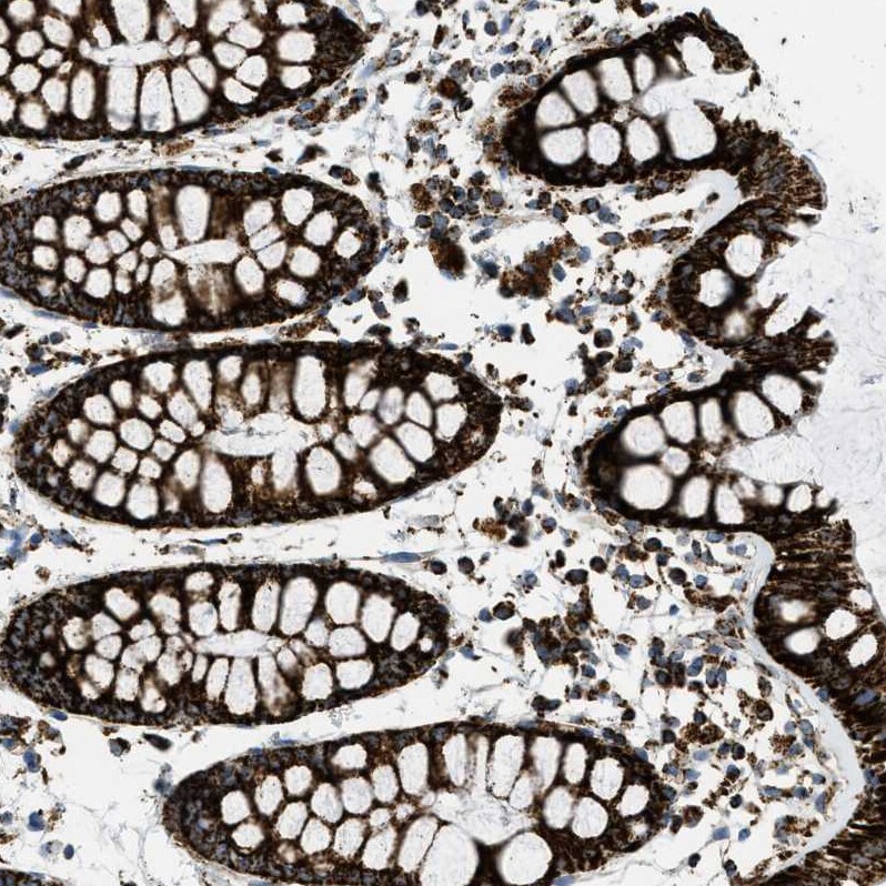 SQRDL Antibody - BSA Free Immunohistochemistry-Paraffin: SQRDL Antibody [NBP1-84510]