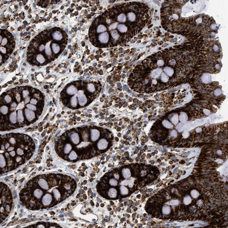 SQRDL Antibody - BSA Free Immunohistochemistry-Paraffin: SQRDL Antibody [NBP1-84510]
