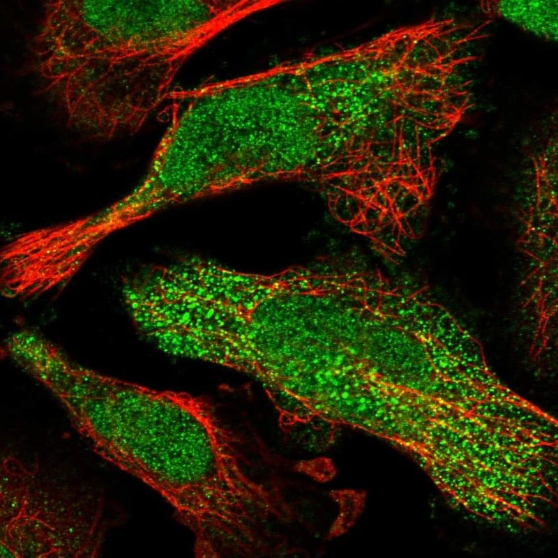 CUTC Antibody - BSA Free Immunocytochemistry/ Immunofluorescence: CUTC Antibody [NBP1-84512]
