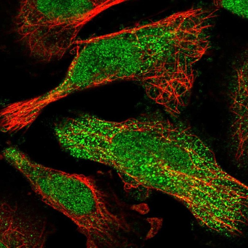 CUTC Antibody - BSA Free Immunocytochemistry/ Immunofluorescence: CUTC Antibody - BSA Free [NBP1-84512]