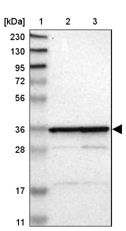 MRPL2 Antibody - BSA Free Western Blot: MRPL2 Antibody - BSA Free [NBP1-84513]