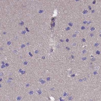 AMDHD2 Antibody - BSA Free Immunohistochemistry-Paraffin: AMDHD2 Antibody [NBP1-84515]