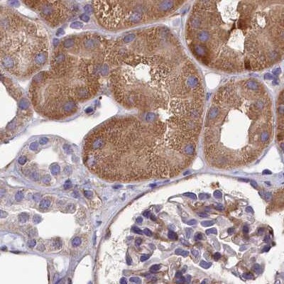 AMDHD2 Antibody - BSA Free Immunohistochemistry-Paraffin: AMDHD2 Antibody [NBP1-84516]