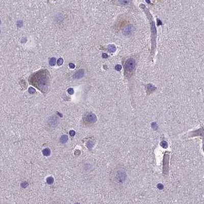 AMDHD2 Antibody - BSA Free Immunohistochemistry-Paraffin: AMDHD2 Antibody [NBP1-84516]