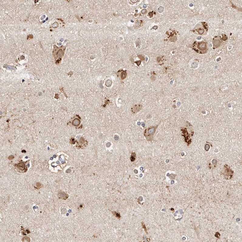 MRPS33 Antibody - BSA Free Immunohistochemistry-Paraffin: MRPS33 Antibody - BSA Free [NBP1-84517]