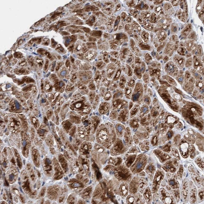 MRPS23 Antibody - BSA Free Immunohistochemistry-Paraffin: MRPS23 Antibody [NBP1-84518]