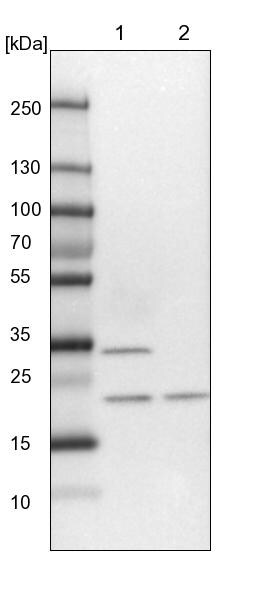 Exosome component 1 Antibody - BSA Free Western Blot: Exosome component 1 Antibody - BSA Free [NBP1-84523]