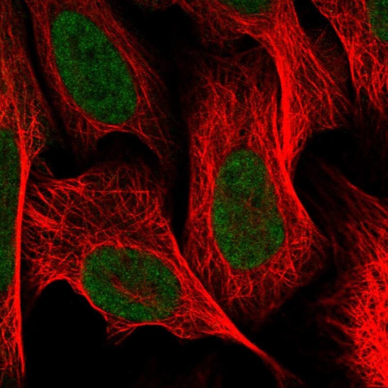 CGGBP1 Antibody - BSA Free Immunocytochemistry/ Immunofluorescence: CGGBP1 Antibody - BSA Free [NBP1-84528]