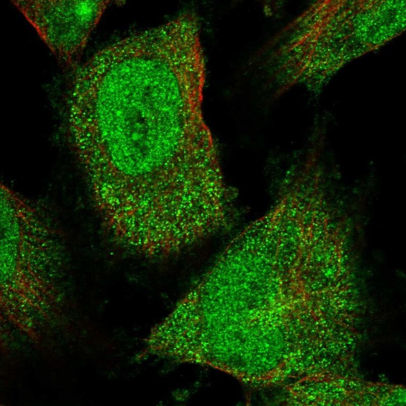 FAM206A Antibody - BSA Free Immunocytochemistry/ Immunofluorescence: FAM206A Antibody [NBP1-84529]