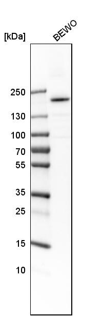 M-CSFR/CD115 Antibody - BSA Free Western Blot: M-CSFR/CD115 Antibody - BSA Free [NBP1-84532]