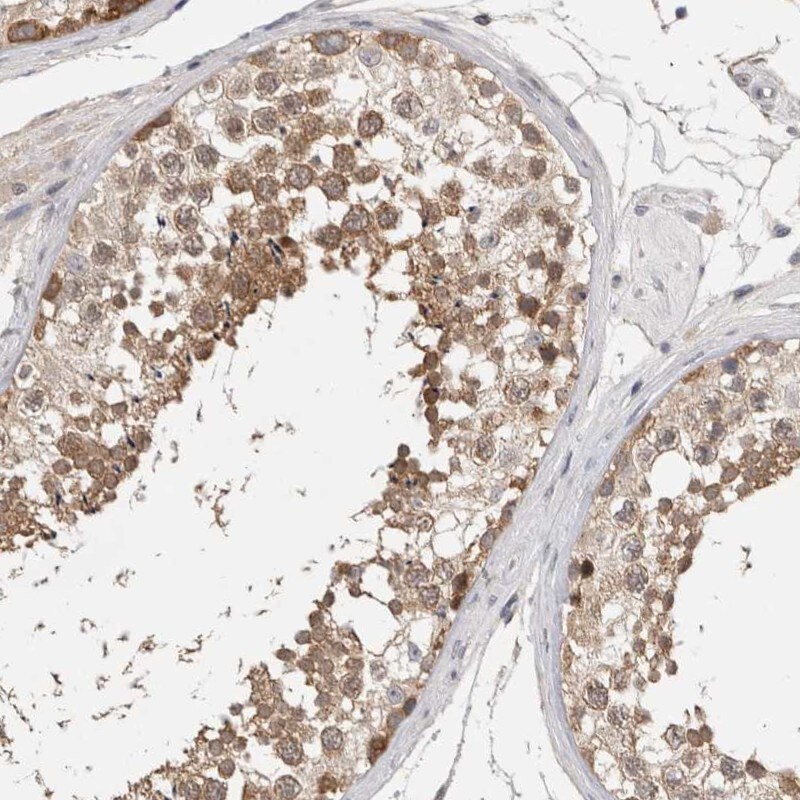 LASS3 Antibody - BSA Free Immunohistochemistry-Paraffin: LASS3 Antibody [NBP1-84535]