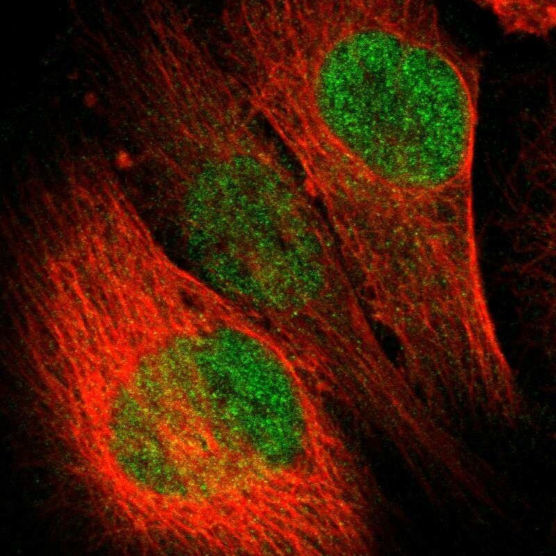 LASS3 Antibody - BSA Free Immunocytochemistry/ Immunofluorescence: LASS3 Antibody [NBP1-84536]