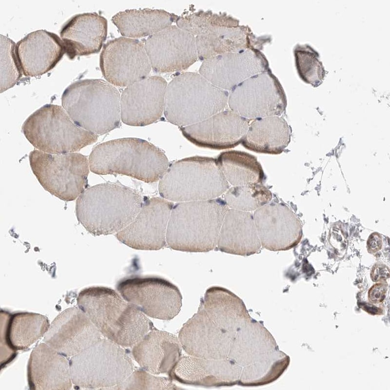 LASS2 Antibody - BSA Free Immunohistochemistry-Paraffin: LASS2 Antibody [NBP1-84537]