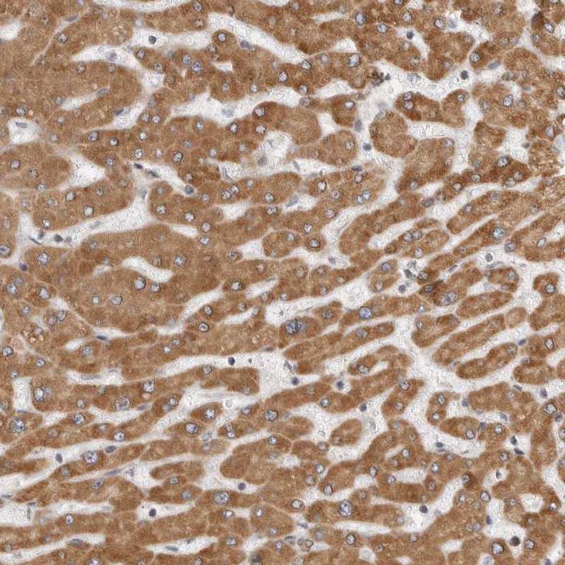 LASS2 Antibody - BSA Free Immunohistochemistry-Paraffin: LASS2 Antibody [NBP1-84537]