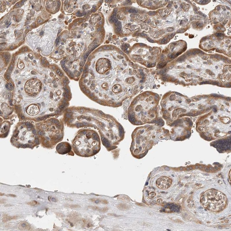 LASS2 Antibody - BSA Free Immunohistochemistry-Paraffin: LASS2 Antibody [NBP1-84537]