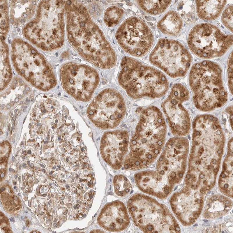LASS2 Antibody - BSA Free Immunohistochemistry-Paraffin: LASS2 Antibody [NBP1-84537]