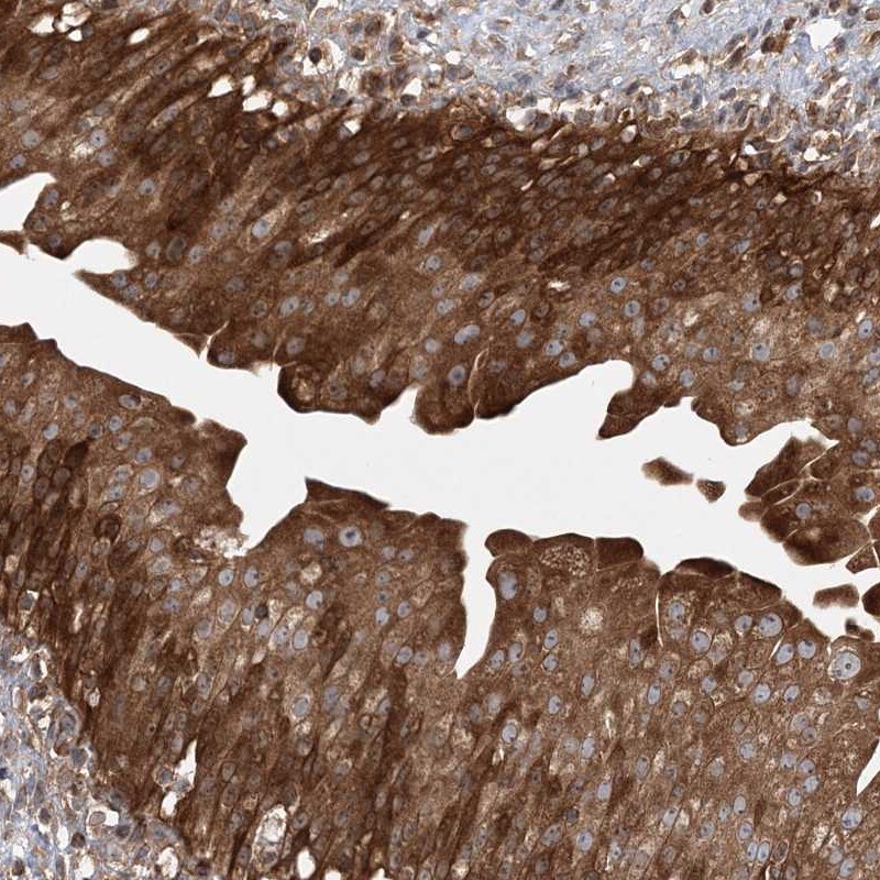 Centaurin beta 2 Antibody - BSA Free Immunohistochemistry-Paraffin: Centaurin beta 2 Antibody [NBP1-84543]