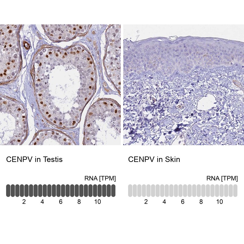 CENPV Antibody - BSA Free Immunohistochemistry-Paraffin: CENPV Antibody - BSA Free [NBP1-84545]