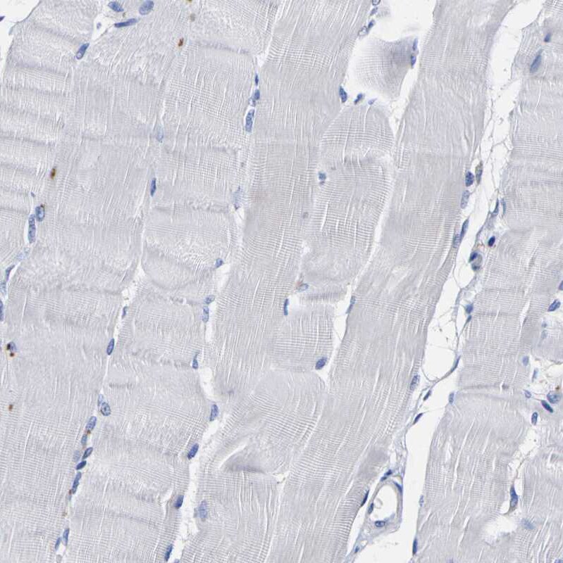 HLA DQA1 Antibody - BSA Free Immunohistochemistry-Paraffin: HLA DQA1 Antibody - BSA Free [NBP1-84550]