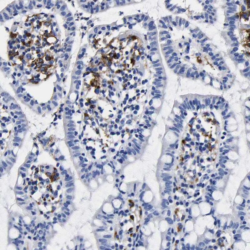 HLA DQA1 Antibody - BSA Free Immunohistochemistry-Paraffin: HLA DQA1 Antibody - BSA Free [NBP1-84550]