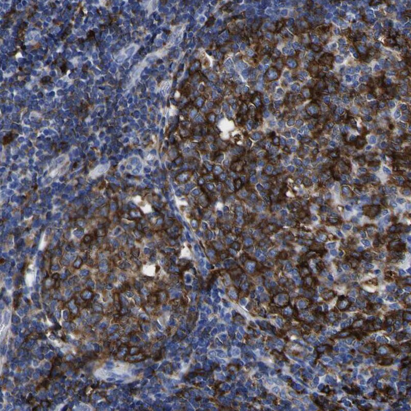 HLA DQA1 Antibody - BSA Free Immunohistochemistry-Paraffin: HLA DQA1 Antibody - BSA Free [NBP1-84550]