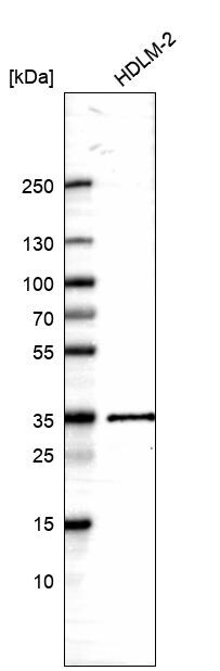 HLA DQA1 Antibody - BSA Free Western Blot: HLA DQA1 Antibody - BSA Free [NBP1-84550]