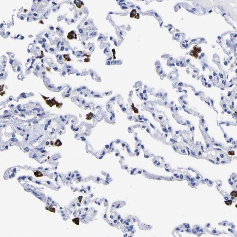 HLA DQA1 Antibody - BSA Free Immunohistochemistry-Paraffin: HLA DQA1 Antibody - BSA Free [NBP1-84550]