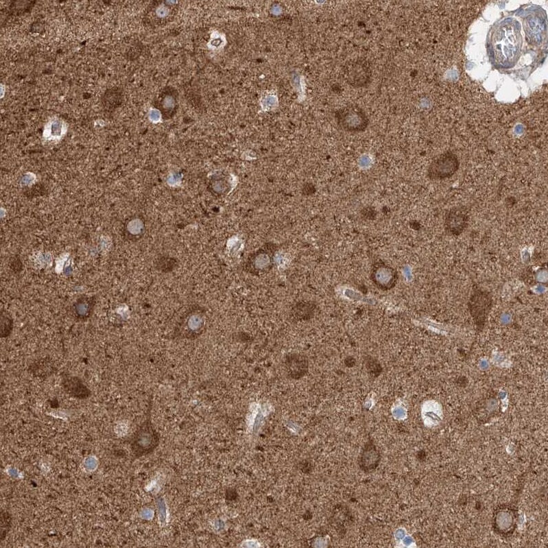 SNAP29 Antibody - BSA Free Immunohistochemistry-Paraffin: SNAP29 Antibody - BSA Free [NBP1-84552]