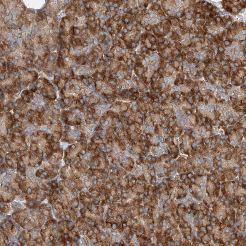 SNAP29 Antibody - BSA Free Immunohistochemistry-Paraffin: SNAP29 Antibody - BSA Free [NBP1-84552]