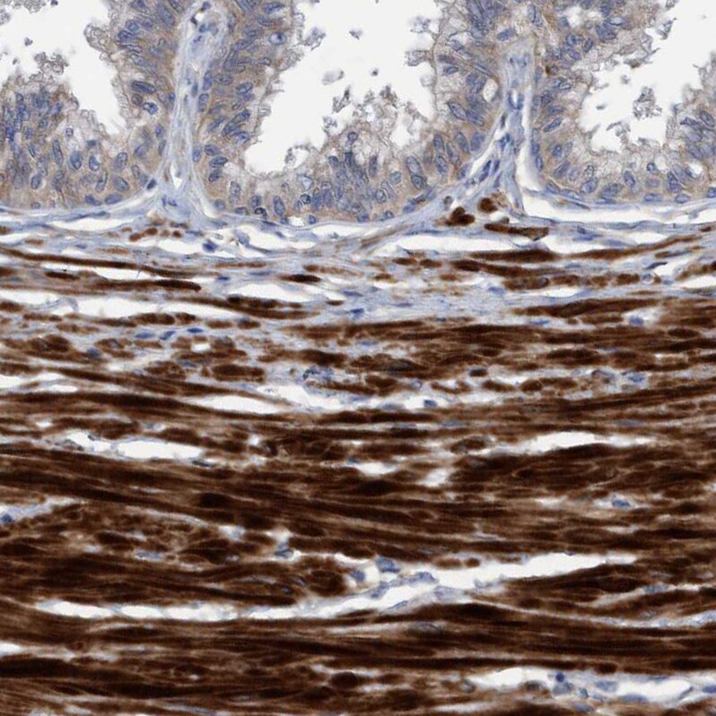 GULP1/CED-6 Antibody - BSA Free Immunohistochemistry-Paraffin: GULP1/CED-6 Antibody - BSA Free [NBP1-84553]