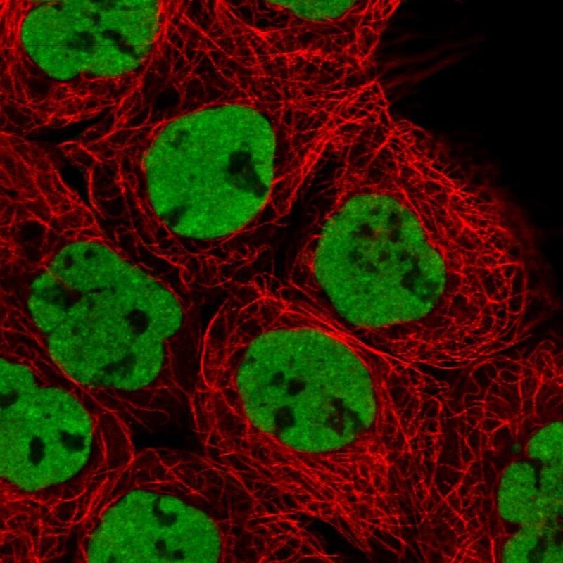 hnRNP M1-M4 Antibody - BSA Free Immunocytochemistry/ Immunofluorescence: hnRNP M1-M4 Antibody - BSA Free [NBP1-84555]