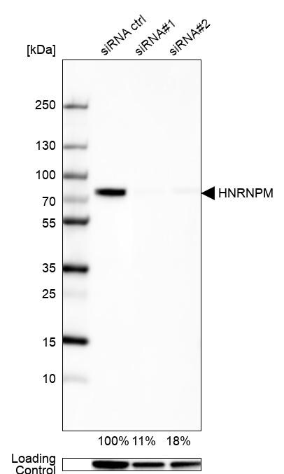 hnRNP M1-M4 Antibody - BSA Free Western Blot: hnRNP M1-M4 Antibody - BSA Free [NBP1-84555]