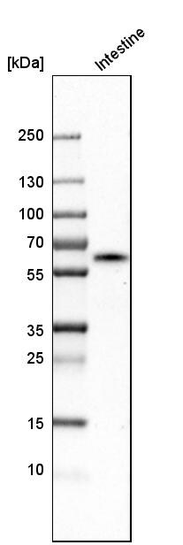 Carboxylesterase 2/CES2 Antibody - BSA Free Western Blot: Carboxylesterase 2/CES2 Antibody - BSA Free [NBP1-84556]