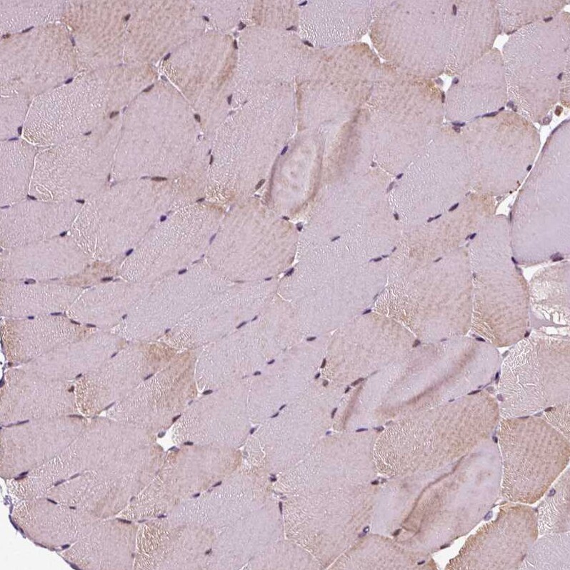 Cdc14A Antibody - BSA Free Immunohistochemistry-Paraffin: Cdc14A Antibody - BSA Free [NBP1-84573]