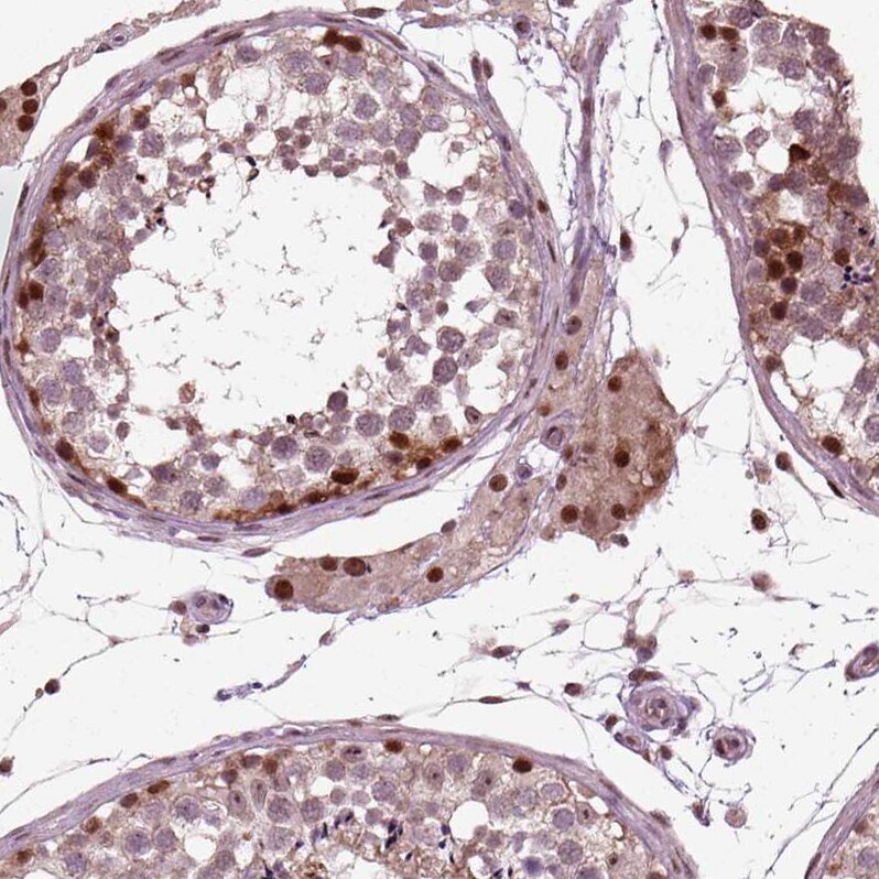 Cdc14A Antibody - BSA Free Immunohistochemistry-Paraffin: Cdc14A Antibody - BSA Free [NBP1-84573]