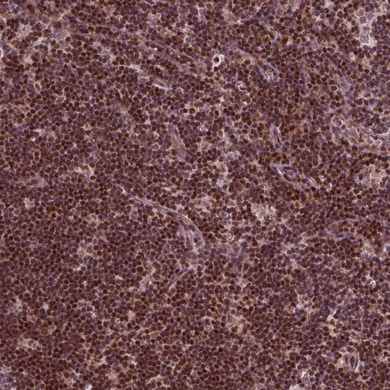 Cdc14A Antibody - BSA Free Immunohistochemistry-Paraffin: Cdc14A Antibody - BSA Free [NBP1-84573]