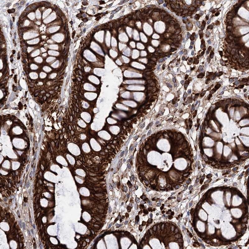 CDAN1 Antibody - BSA Free Immunohistochemistry-Paraffin: CDAN1 Antibody [NBP1-84574]