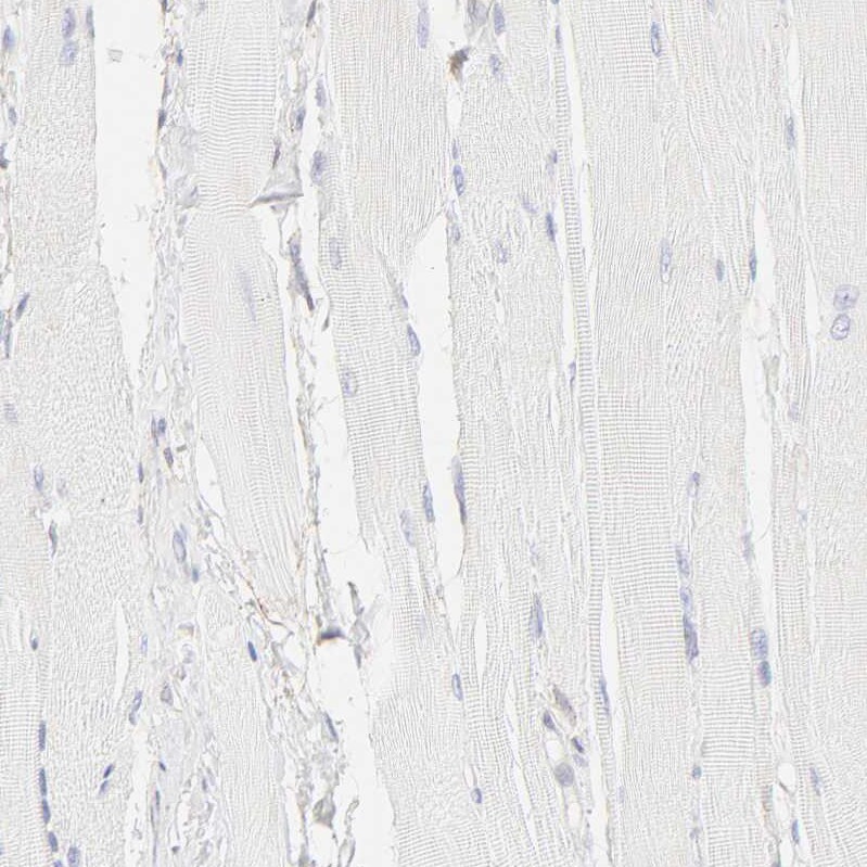 Integrin alpha 5/CD49e Antibody - BSA Free Immunohistochemistry-Paraffin: Integrin alpha 5/CD49e Antibody [NBP1-84576]