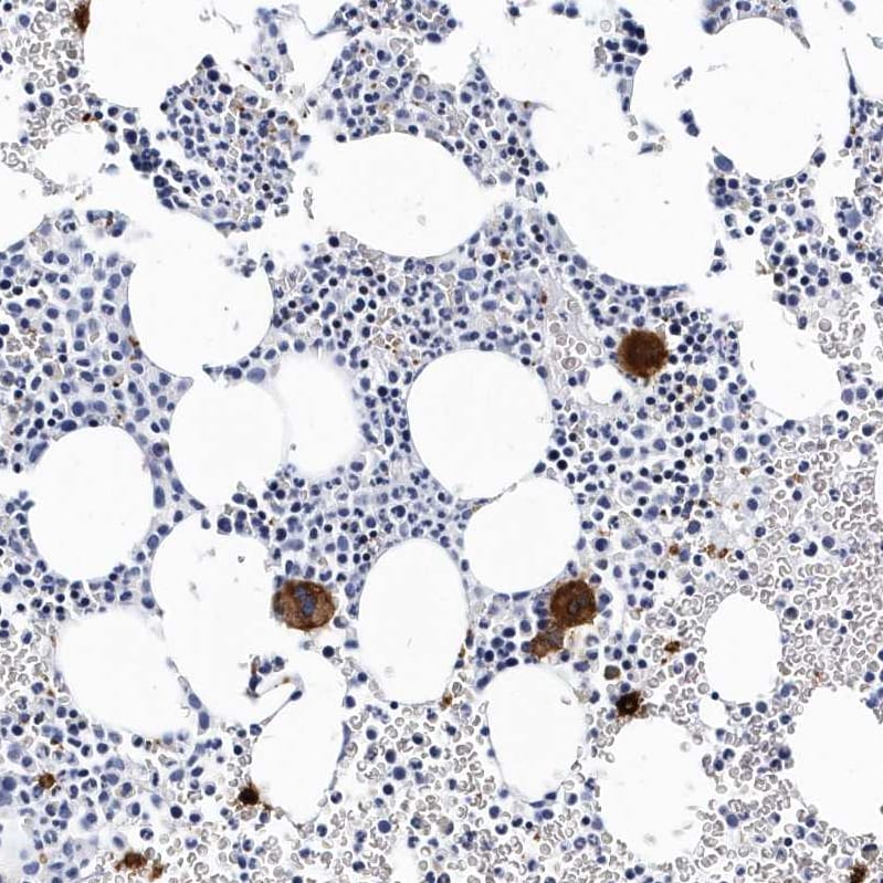 Integrin alpha 2b/CD41 Antibody - BSA Free Immunohistochemistry-Paraffin: Integrin alpha 2b/CD41 Antibody - BSA Free [NBP1-84579]
