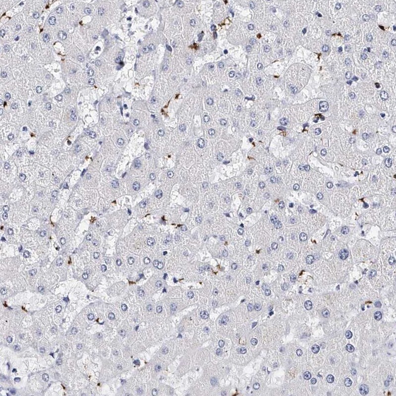 Integrin alpha 2b/CD41 Antibody - BSA Free Immunohistochemistry-Paraffin: Integrin alpha 2b/CD41 Antibody - BSA Free [NBP1-84579]