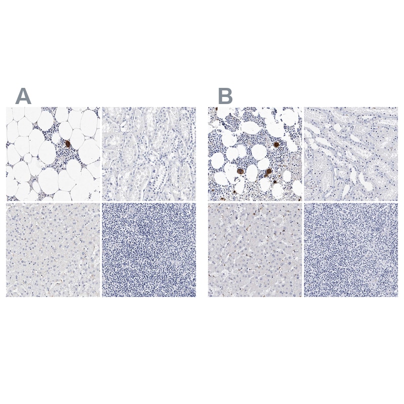 Integrin alpha 2b/CD41 Antibody - BSA Free Immunohistochemistry-Paraffin: Integrin alpha 2b/CD41 Antibody - BSA Free [NBP1-84580]